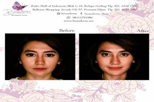 gallery img