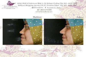 gallery img