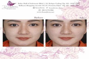 gallery img