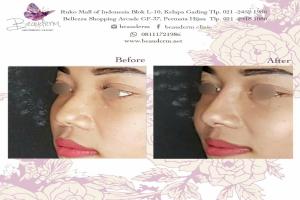 gallery img