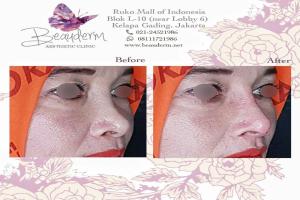 gallery img