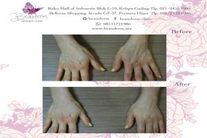 gallery img