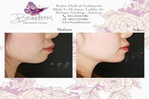 gallery img