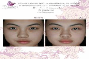 gallery img