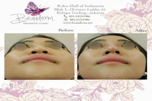 gallery img