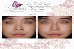 gallery img