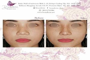 gallery img