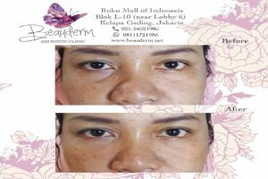 gallery img