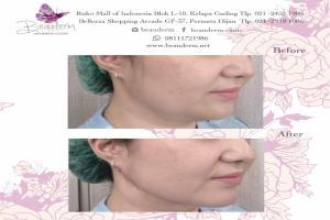 gallery img
