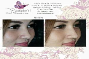 gallery img
