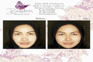gallery img