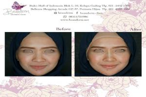 gallery img