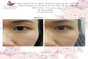 gallery img