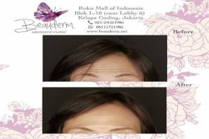 gallery img