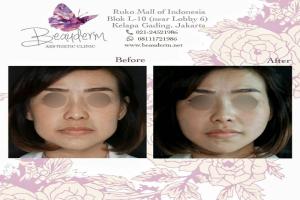 gallery img