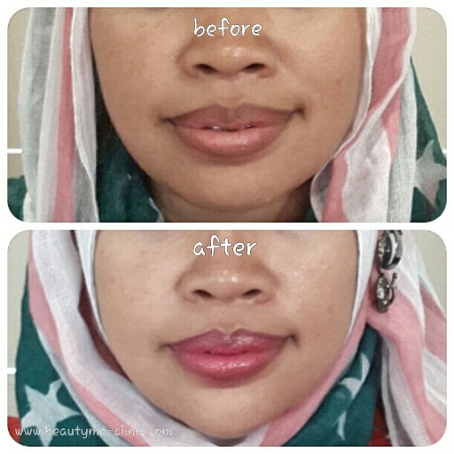 wajah tirus