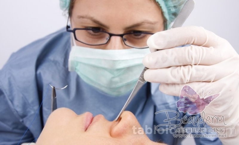 Rekonstruksi Hidung Jangan Sekedar Mancung, Tapi Harus Proporsional