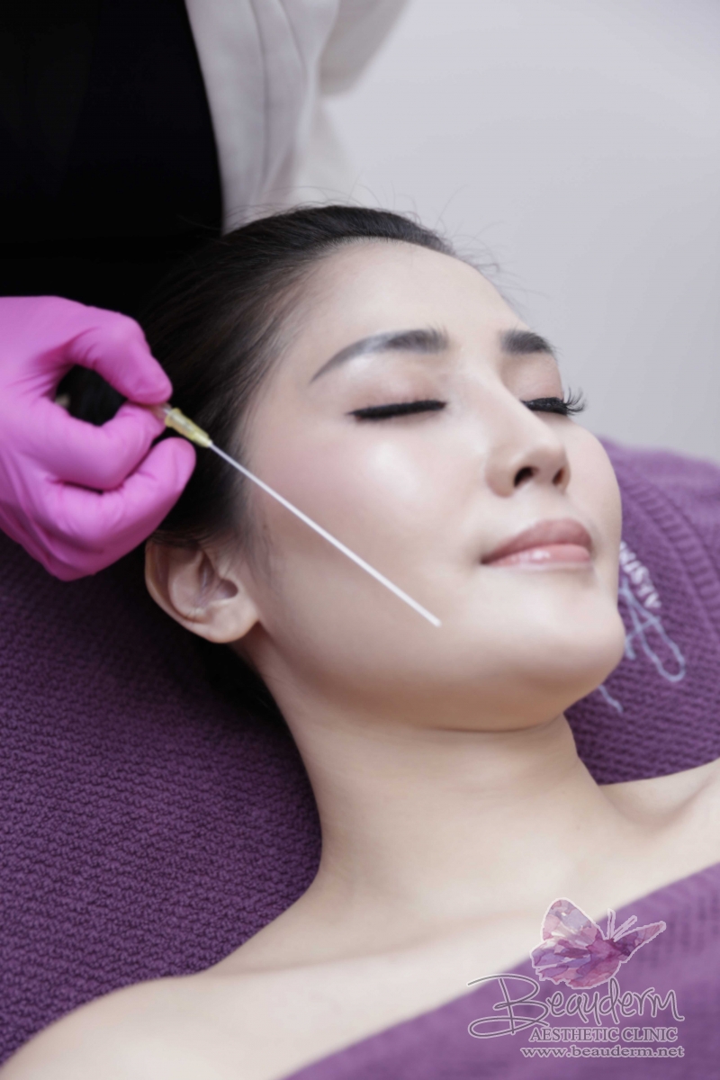 Threadlift Wajah