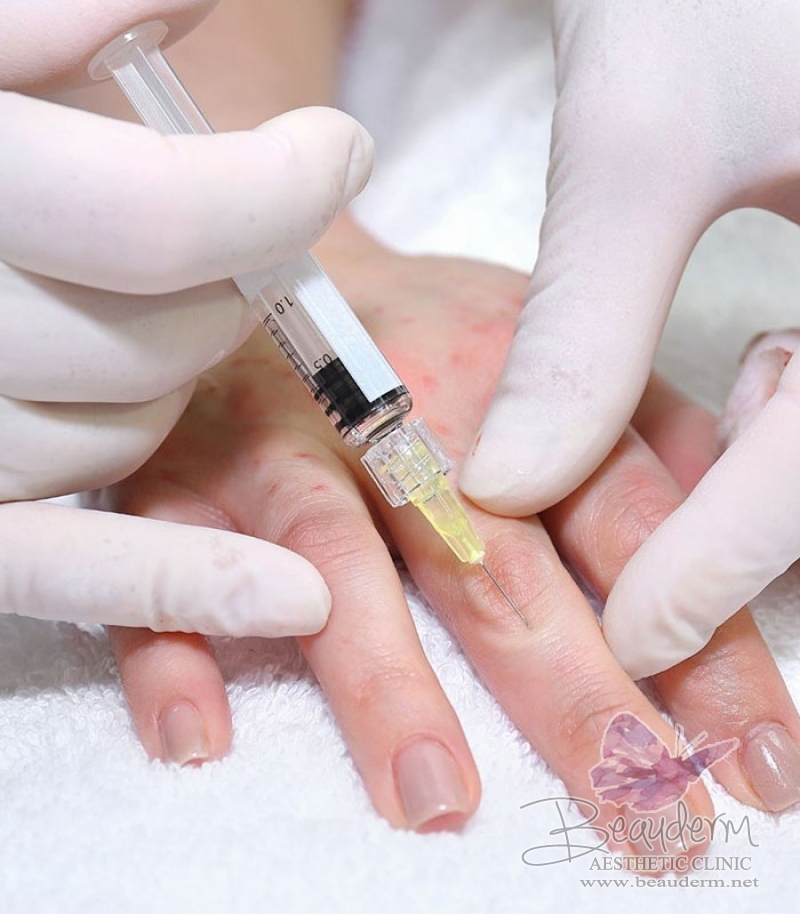 Peremajaan Tangan (Hand Rejuvenation)