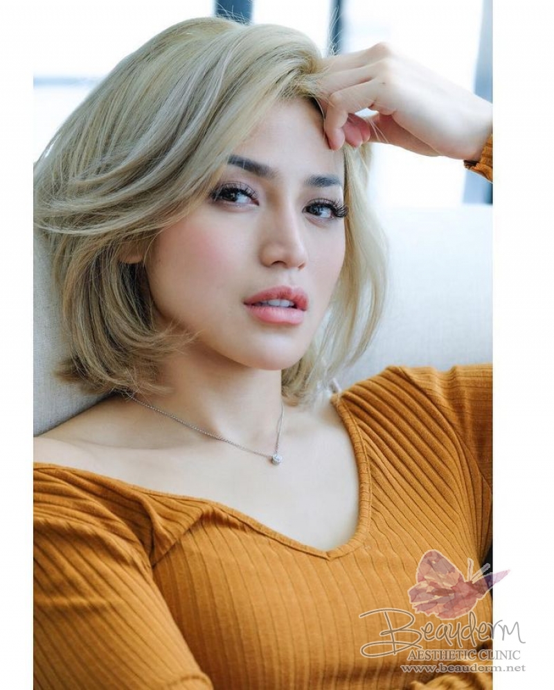 Filler Bibir Ala Jessica Iskandar Kisaran Harga di Indonesia Manfaat, Risiko