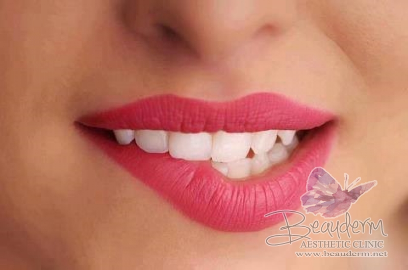Miliki Bibir Indah dan Seksi