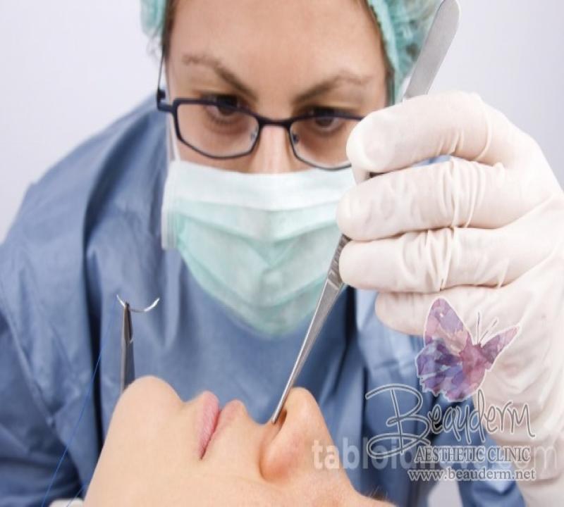 Rekonstruksi Hidung Jangan Sekedar Mancung, Tapi Harus Proporsional
