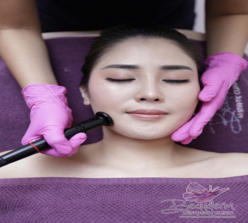 Facial Radio Frequency