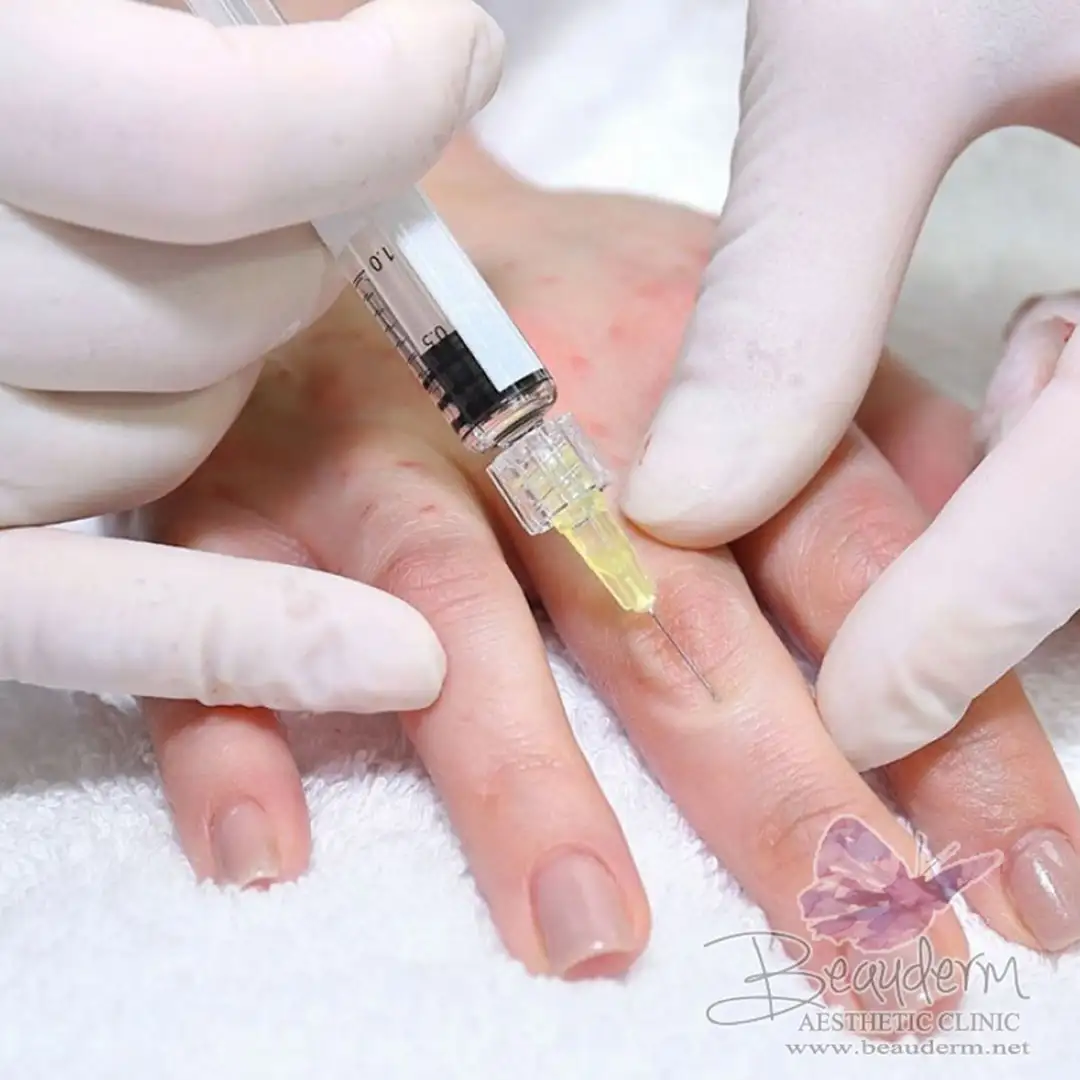 Peremajaan Tangan (Hand Rejuvenation)