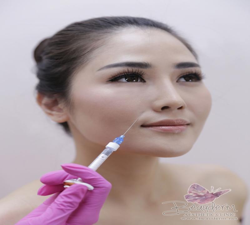Dermal Fillers