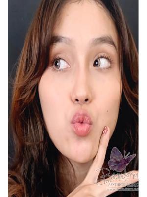 Lip Filler Before After, Meremajakan Bentuk Bibir