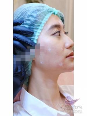 Injectable Skincare Glow