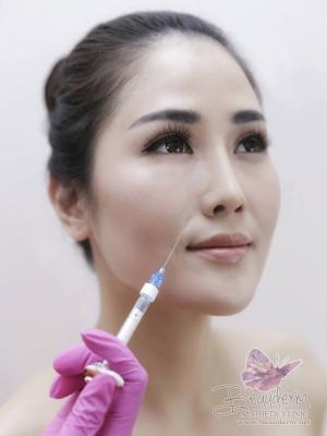 Mengembalikan Kecantikan Wajah