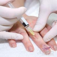 Peremajaan Tangan (Hand Rejuvenation)