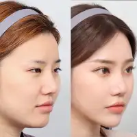 Korea atau Jepang, Manakah Negara Terbaik untuk Operasi Plastik?