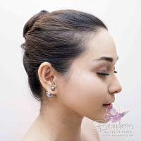 Hidung Mancung Dalam Waktu 15 Menit