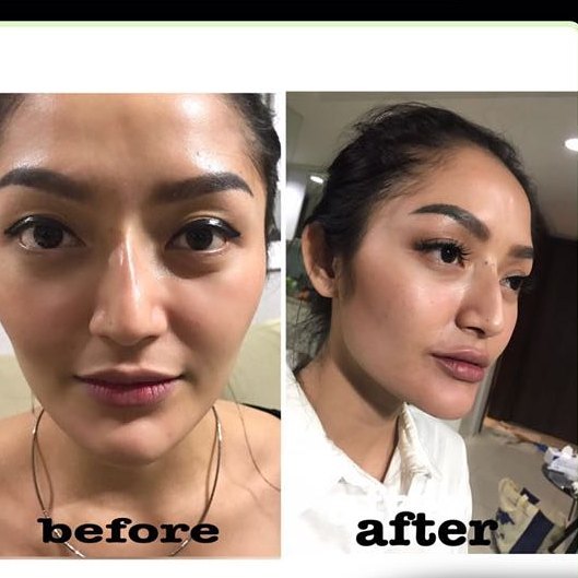 filler artis jakarta